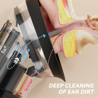 Deep Clean Ear Irrigator – Safe & Powerful Ear Wax Removal